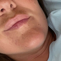 naughty_katarina_free Nua