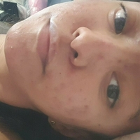 xsugarvulpesx Nua